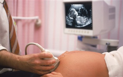 Genetikai ultrahang – mit fed a fogalom? 1. Genetikai ultrahang – mit fed a fogalom? 1.