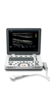 MySono U6 hordozható kardiológiai ultrahang bérlés